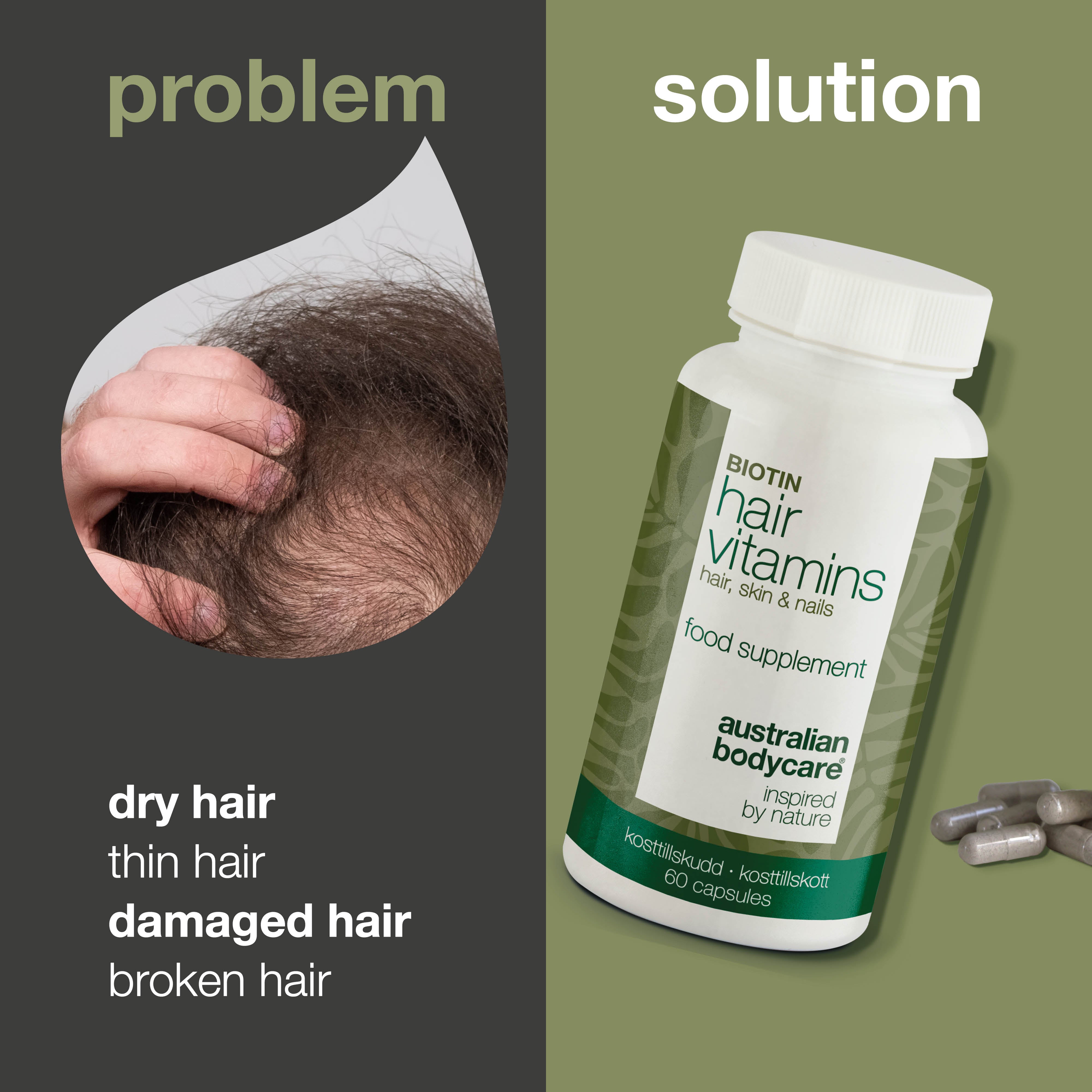 Vitamíny pre zdravé vlasy — Biotín a zinok pre normálne vlasy, prírodné zložky pre optimálnu starostlivosť.