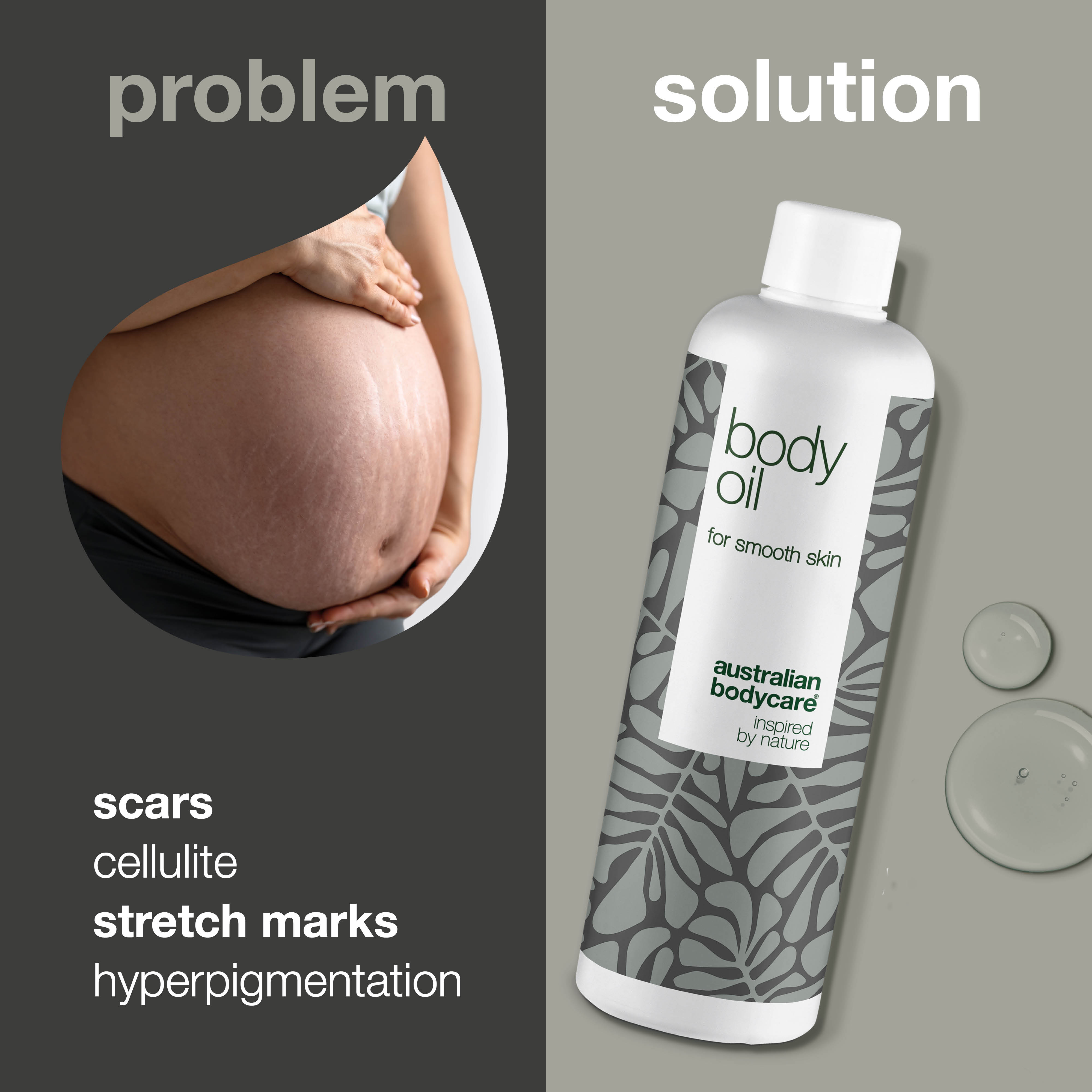 Body Oil – Znižuje strie, jazvy a pigmentové škvrny — Body Oil redukuje strie, jazvy a pigmentové škvrny. Obsahuje mandľový olej, skvalán a vitamín E pre hydratovanú a pružnú pokožku.