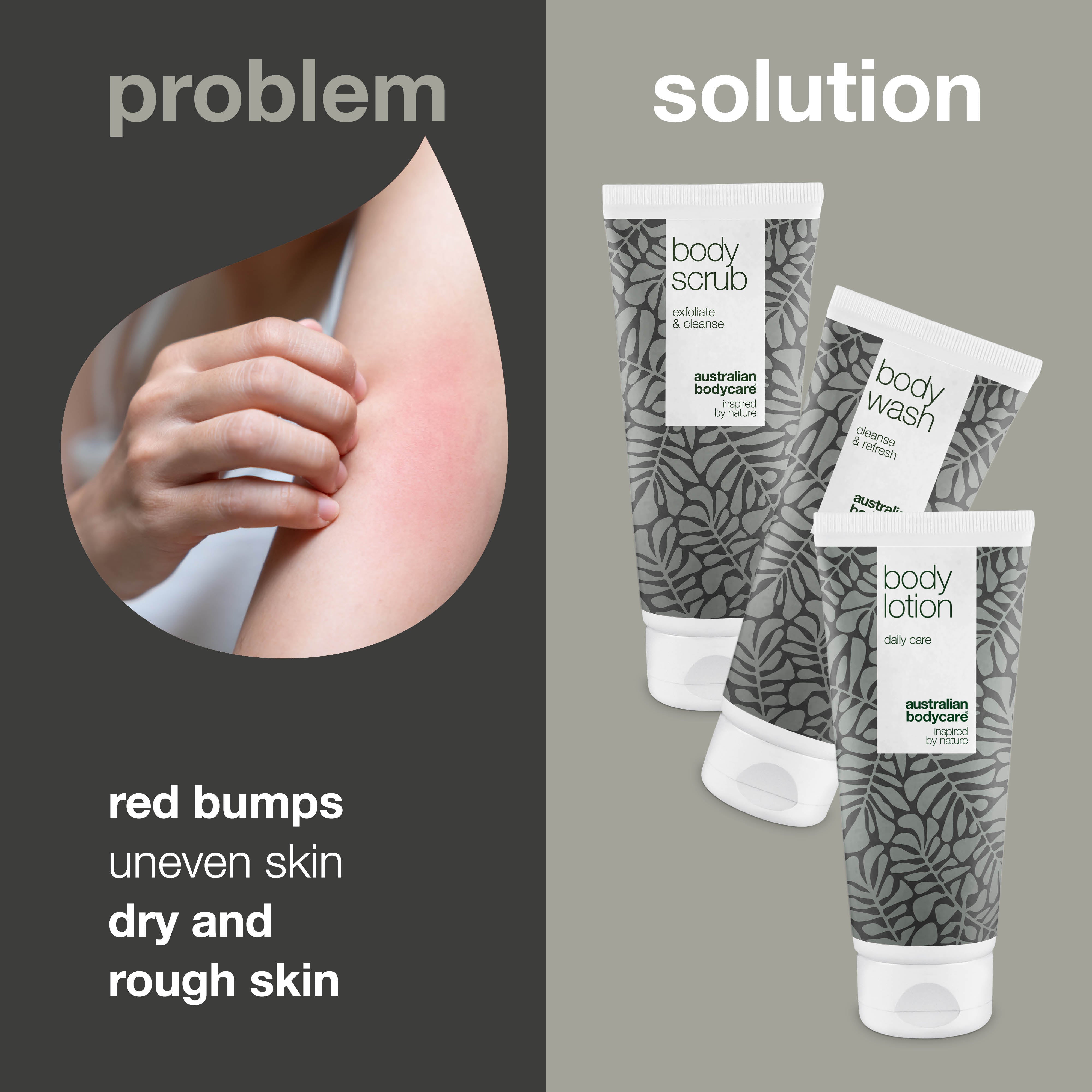 3-dielny set pre keratosis pilaris — Minimalizuje červené hrbolčeky na pokožke spôsobené keratosis pilaris. Rieši červené hrbolčeky na pokožke—Prírodné aktívy pre zdravú pleť