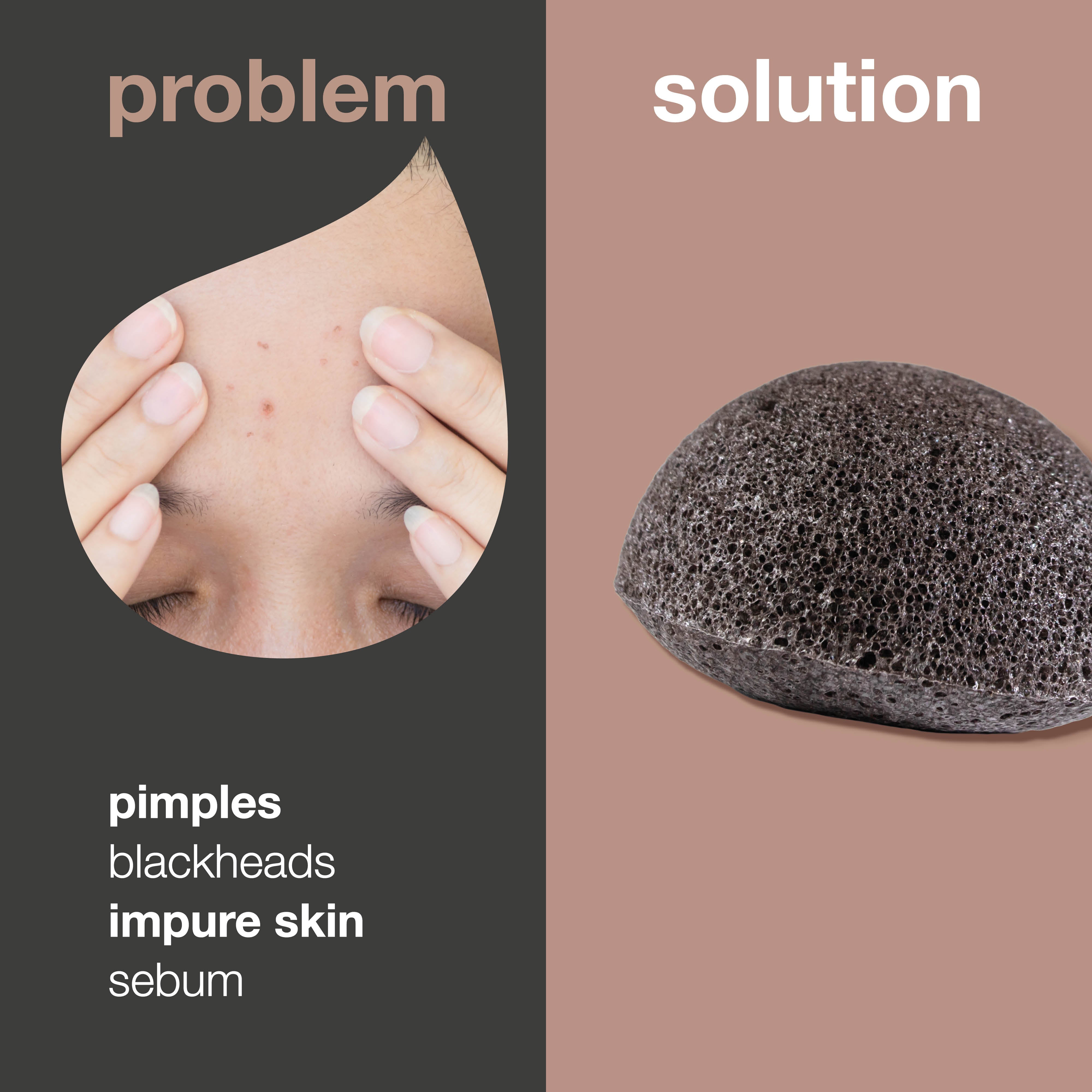 Konjac špongia na problematickú pleť — Jemné exfoliácia s prírodnými aktívami pre čistú pleť bez nedokonalostí.