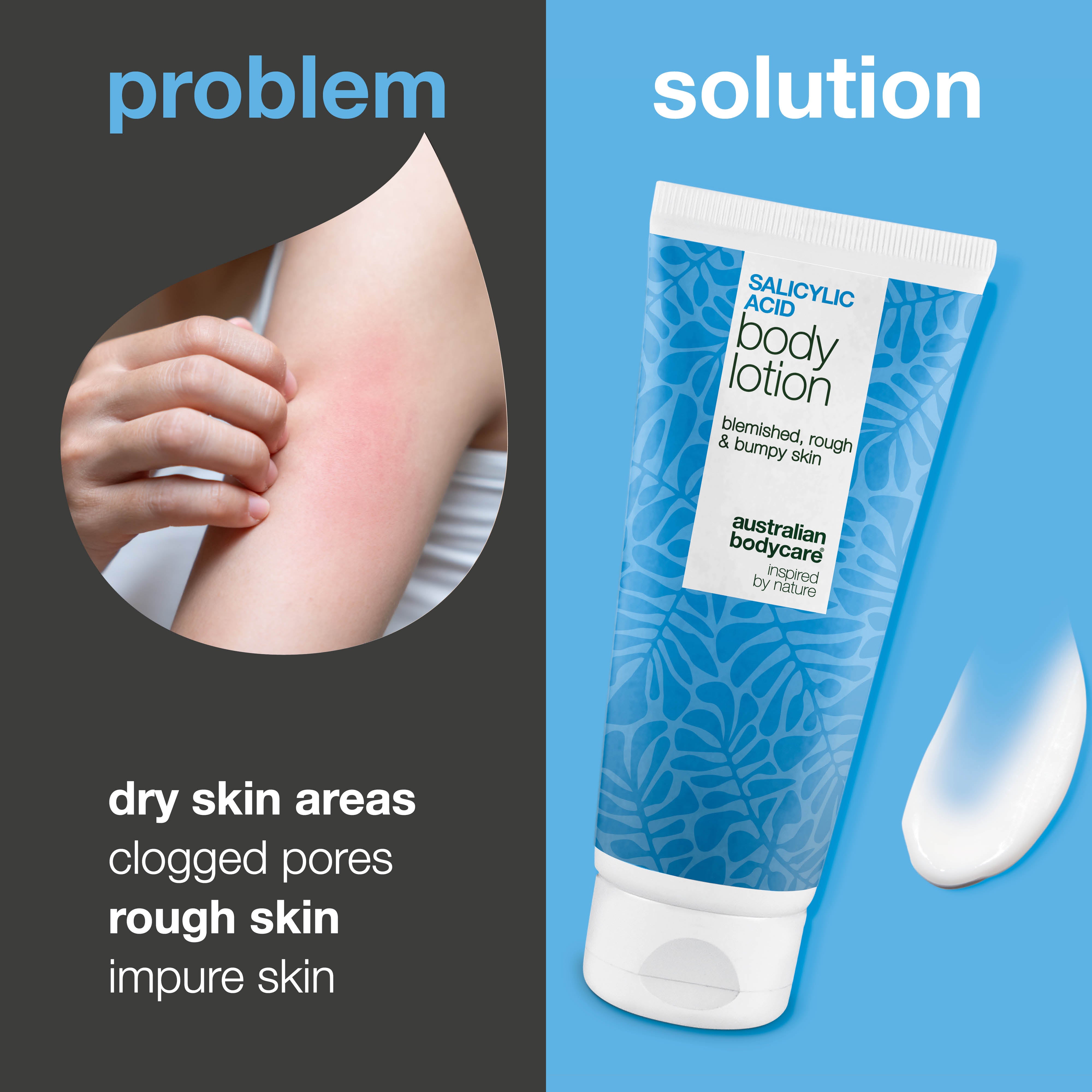 Telové mlieko s kyselina salicylová – suchá a drsná pokožka — Telové mlieko s kyselina salicylová jemne exfoliuje, hydratuje a pomáha zjemniť suchú a drsnú pokožku. Ideálne na každodenné použitie.