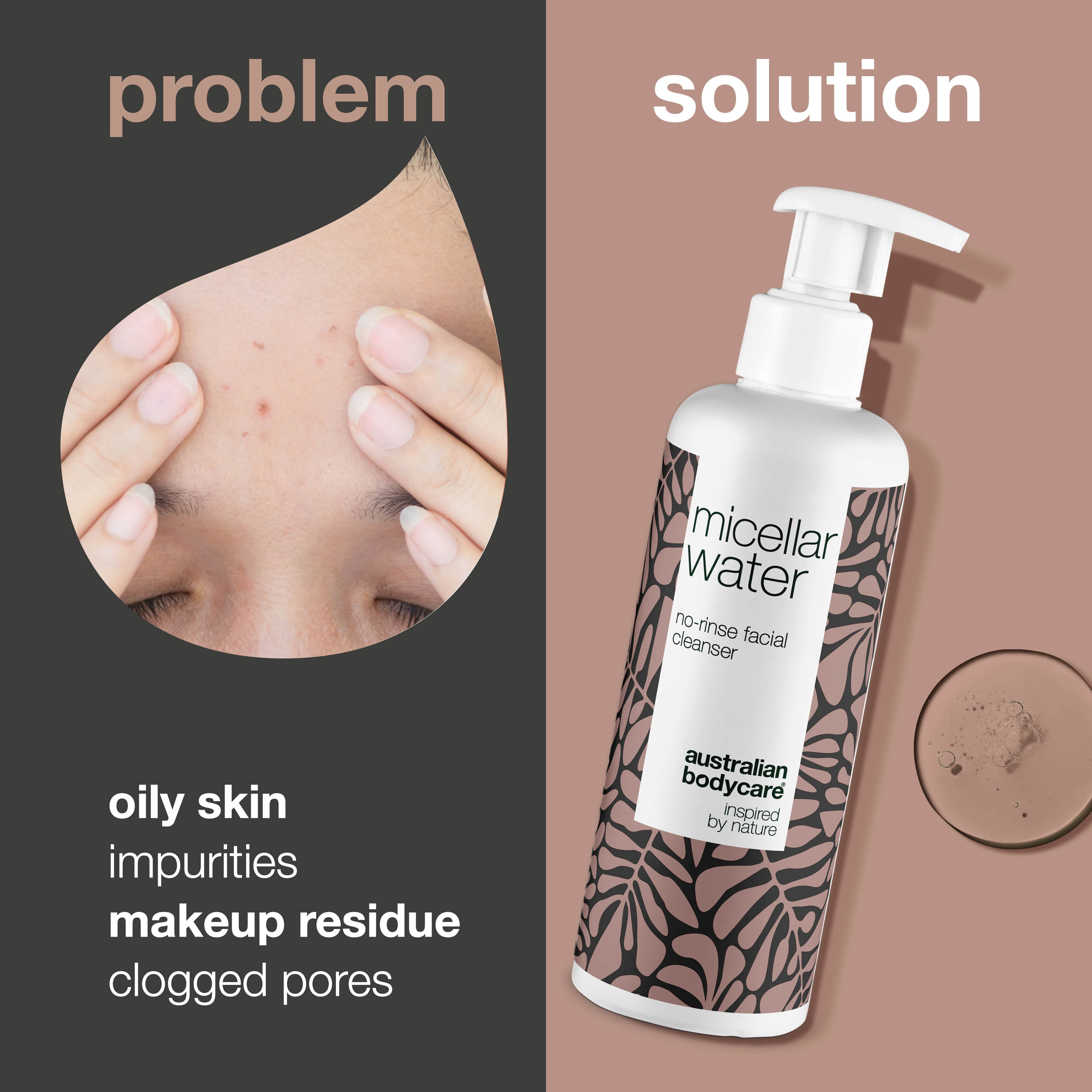 Micellar Water – Efektívna Starostlivosť o Mastnú a Nečistú Pleť — Micellar Water odstraňuje make-up, nečistoty a prebytočný maz. Ideálny na každodenné čistenie pleti.