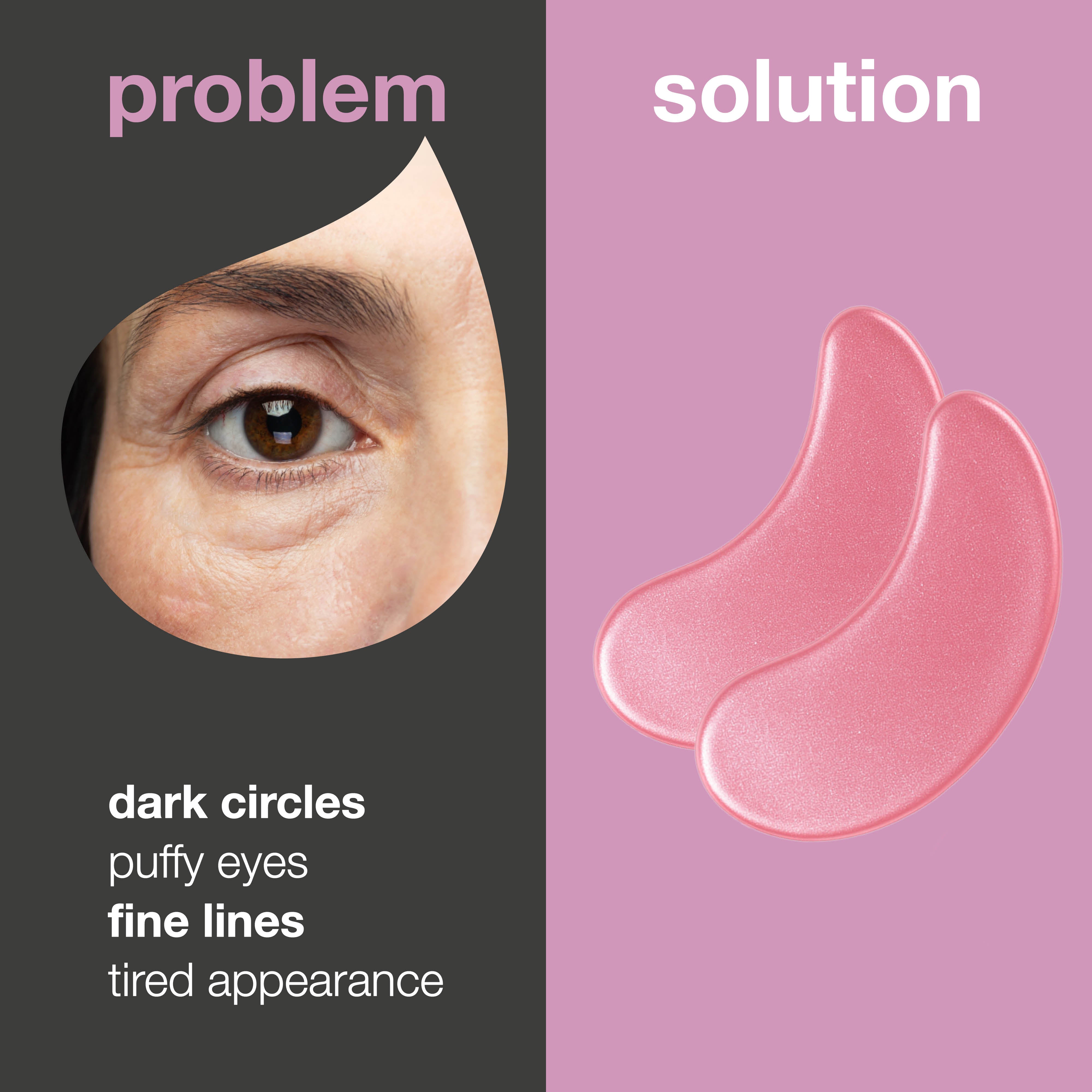 Eye Patches s Vitamínom B12 a Kolagén na Kruhy a Opuchy pod Očami — Redukujte kruhy a opuchy pod očami s maskami s vitamínom B12. Hydratujú a osviežujú pleť už za 20 minút. Ideálne pre unavené oči!