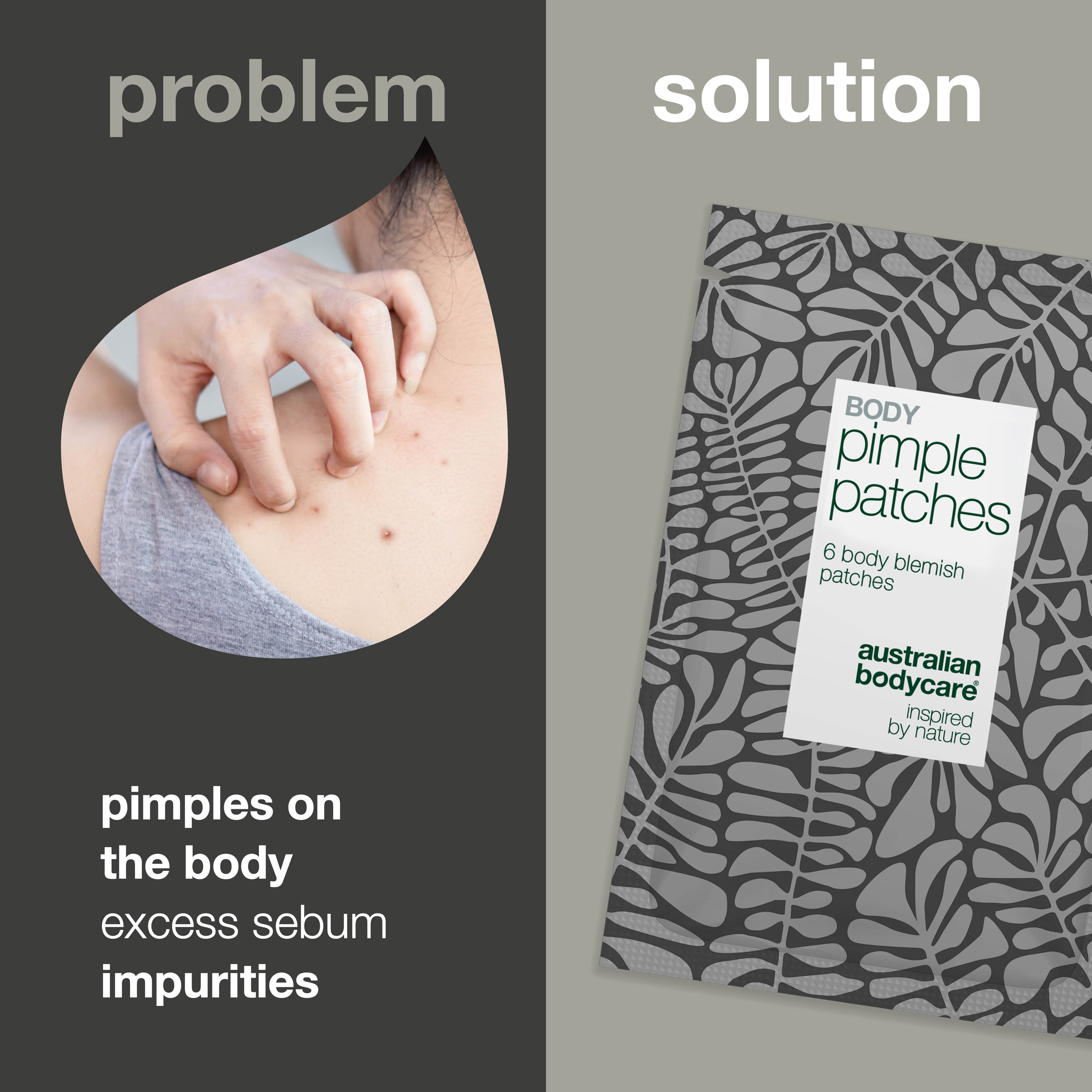 Body Pimple Patches – Náplasti na akné na telo — Odstráňte akné na chrbte, hrudi a ramenách. Náplasti absorbujú maz a chránia pokožku pred baktériami.