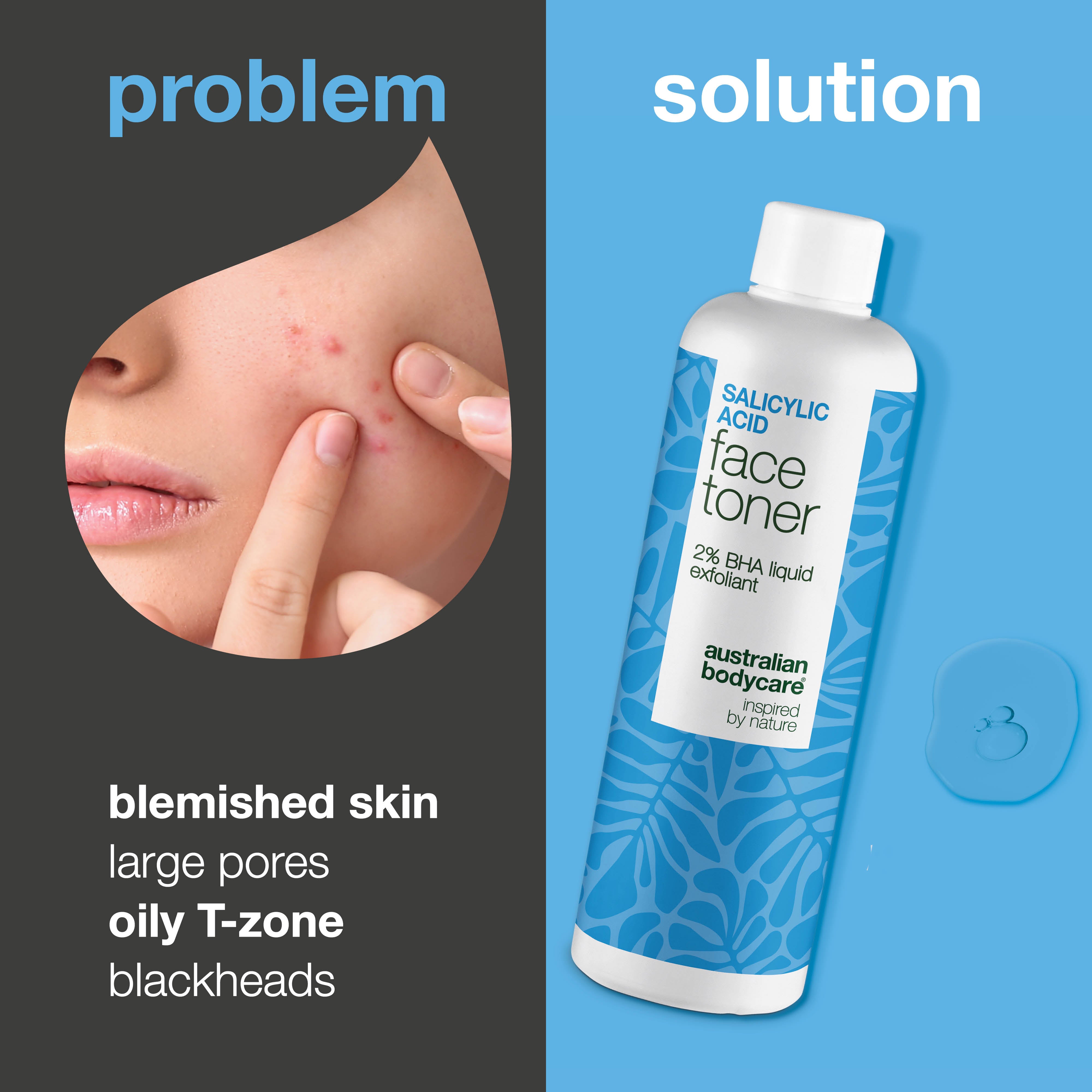 Salicylic Acid toner pomáha pri nedokonalostiach, čiernych bodkách a nerovnej pokožke. Účinná starostlivosť so Salicylic Acid od Australian Bodycare.