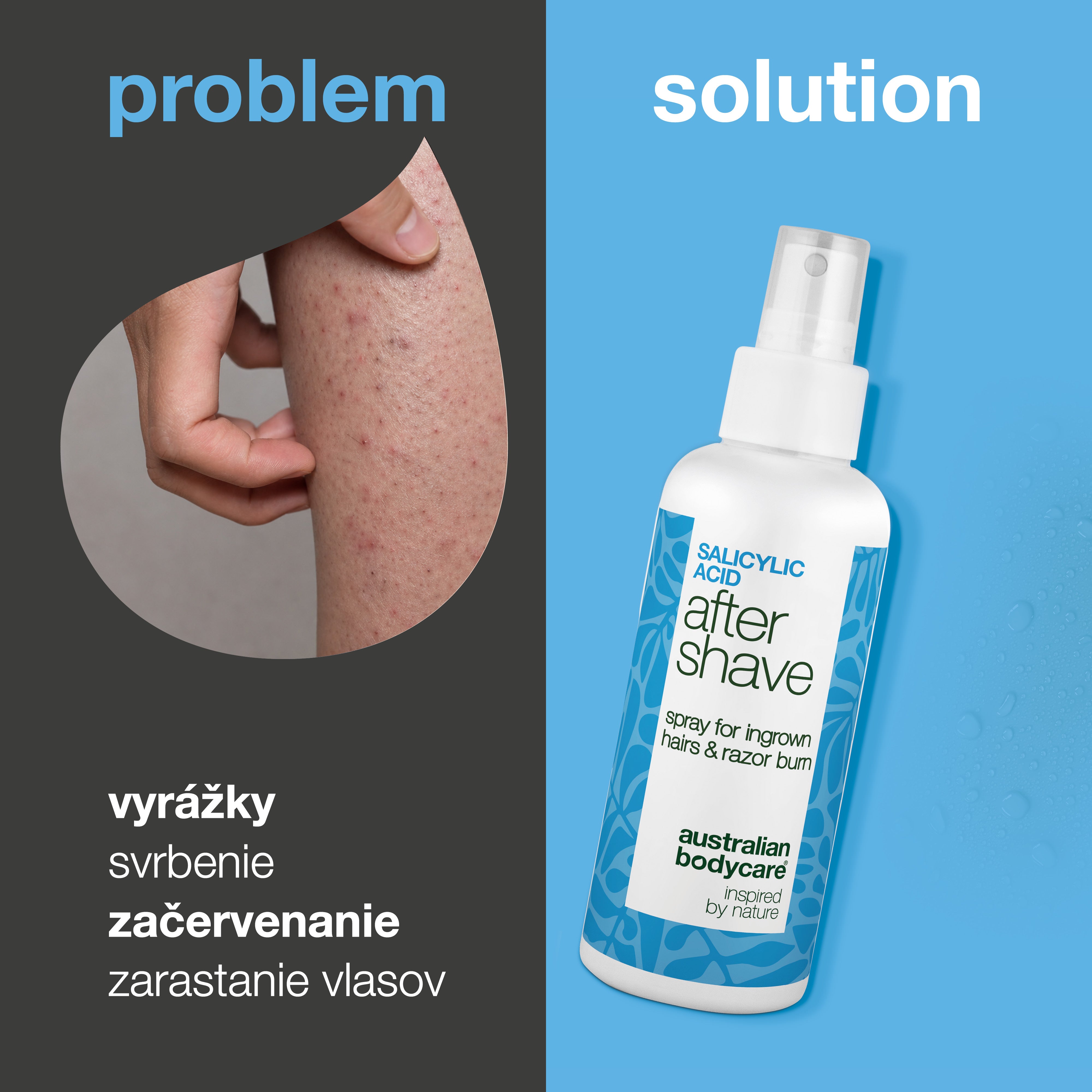 Sprej po holení s kyselinou salicylovou na vyrážky — Sprej po holení na vyrážky a zarastajúce chĺpky. Kyselina salicylová a Aloe Vera upokoja svrbenie pre hladkú pleť. Vyskúšajte ihneď.