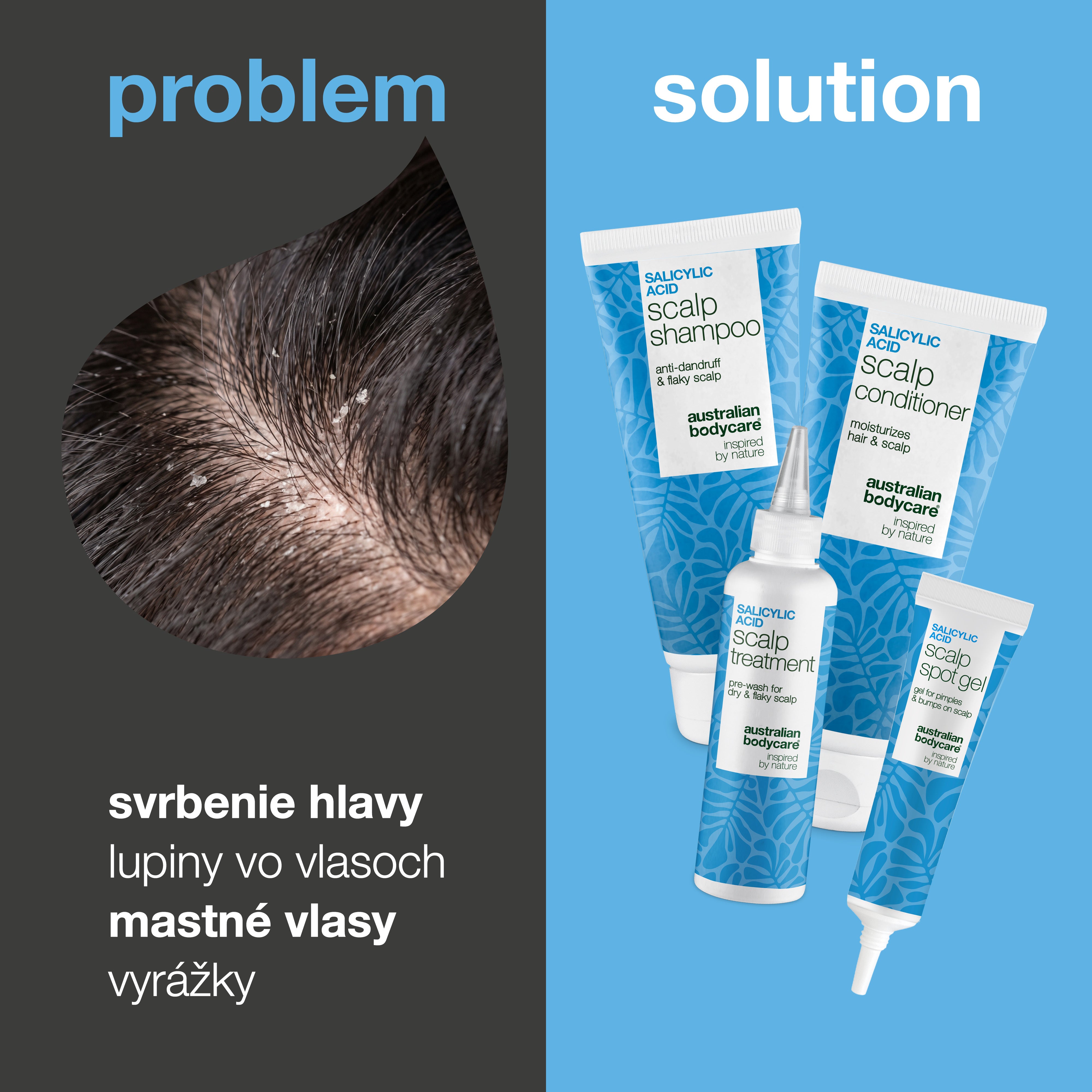 Problém a riešenie: detail lupín vo vlasoch vedľa štyroch produktov sady proti svrbeniu, lupinám a vyrážkam