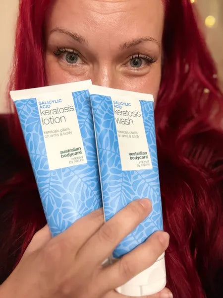 Výsledok zákazníka keratosis pilaris – Viktorija K.